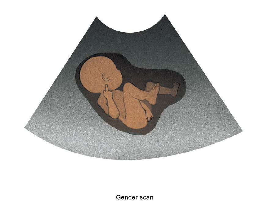 Gender scan