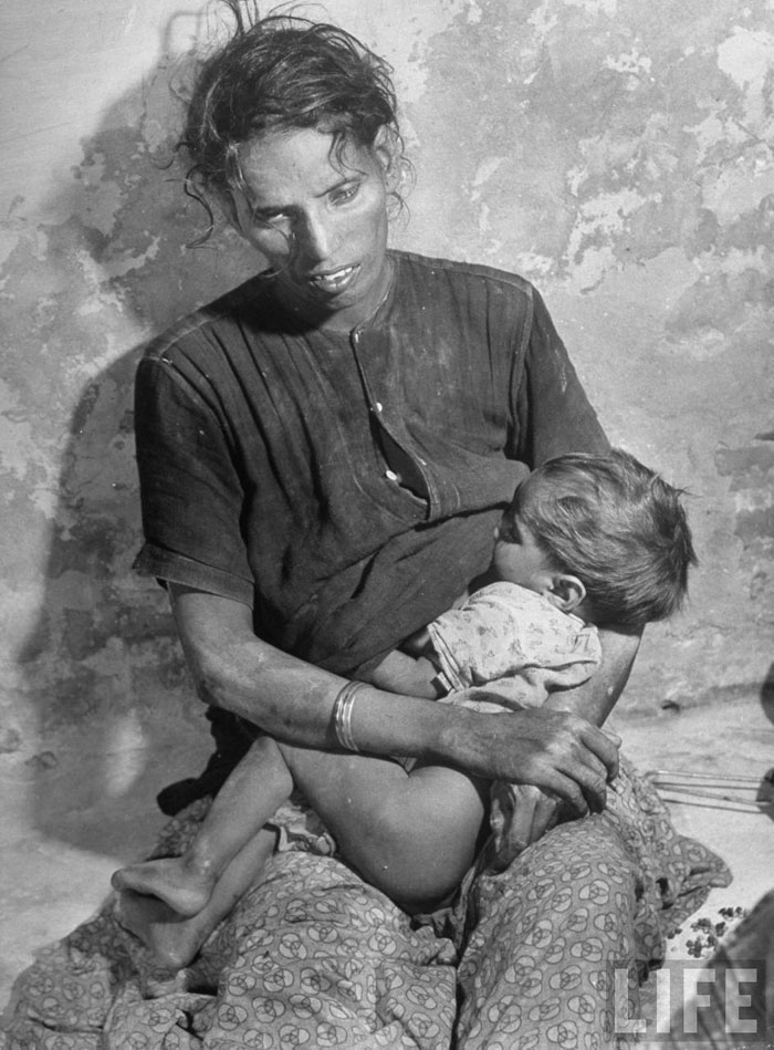 Emaciated Indian woman breast feeds her child despite being on the brink of death herself